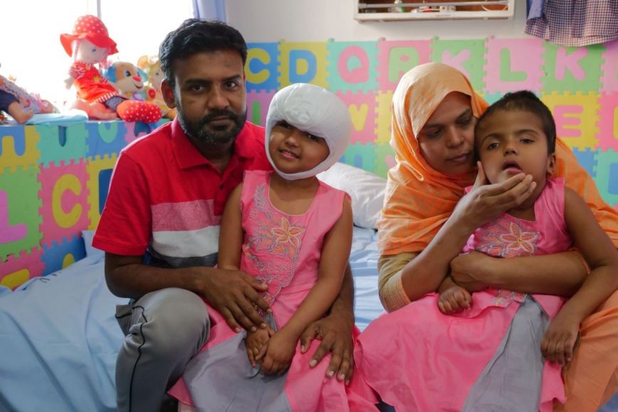 Szétválasztott bangladesi sziámi ikrek: újabb műtét jön